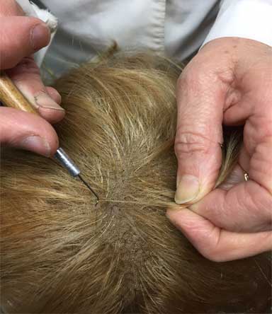 Parrucche e protesi per chemioterapia, alopecia, calvizie a Latina e  Frosinone - De Fabritiis